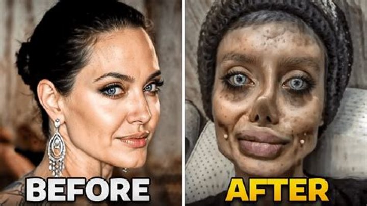 Woman undergoes 43 surgeries to look like Barbie – today people label her a ‘Zombie’
